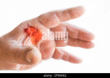 Main d'un homme avec une blessure sanglante sur fond blanc, isolé. Banque D'Images