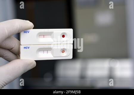 2 Résultats rapides de tests pour le virus de l'hépatite c, résultats négatifs et positifs pour les anticorps du virus de l'hépatite C qui ont été trouvés dans le dépistage du virus c. Banque D'Images