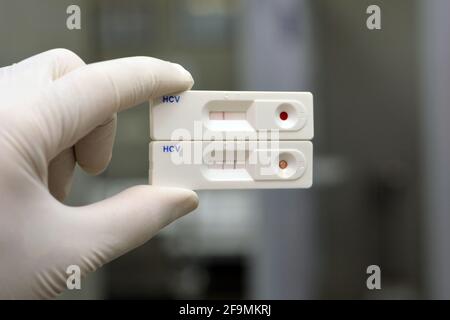 2 Résultats rapides de tests pour le virus de l'hépatite c, résultats négatifs et positifs pour les anticorps du virus de l'hépatite C qui ont été trouvés dans le dépistage du virus c. Banque D'Images