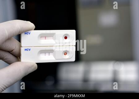 2 Résultats rapides de tests pour le virus de l'hépatite c, résultats négatifs et positifs pour les anticorps du virus de l'hépatite C qui ont été trouvés dans le dépistage du virus c. Banque D'Images