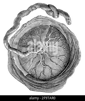 Placenta humain dès la naissance avec le cordon ombilical en place. Illustration du 19e siècle. Allemagne. Arrière-plan blanc. Banque D'Images