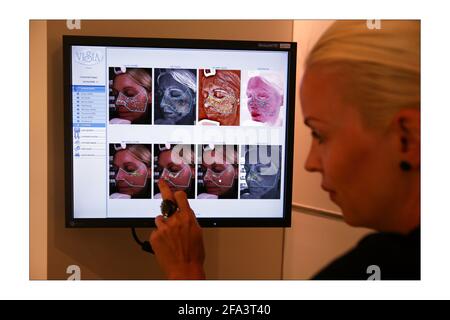 Charlotte Cripps a le premier d'une série de photoréjuvenation Traitements de la peau au laser à Harvey Nichols à Londres.photo de David Sandison l'indépendant Banque D'Images