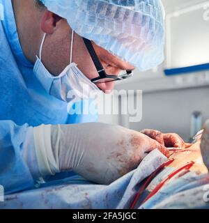 Gros plan d'un médecin de sexe masculin dans des lunettes pour faire remonter la plaie du patient après une intervention chirurgicale de tumme. Homme médecin effectuant une chirurgie plastique abdominale dans la salle d'opération. Concept d'abdominoplastie, chirurgie esthétique. Banque D'Images