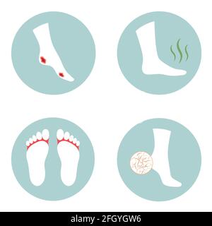 ulcère diabétique, talon fissuré, infection fongique, problèmes de pied piqué, Illustration de Vecteur