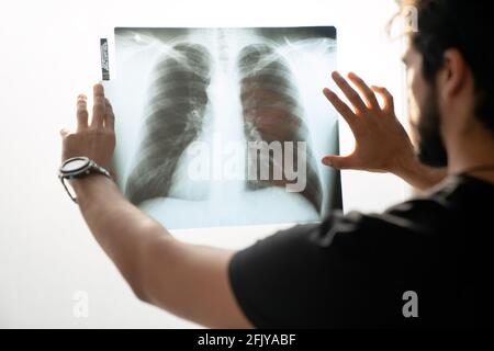 Médecin vérifiant examen de la poitrine film de rayons X du patient sur fond blanc , concept du virus Corona. Banque D'Images