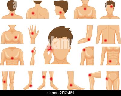 Douleur corporelle. Blessures physiques traumatismes humains symboles sur les jambes épaules mains douleur points ensemble vectoriel Illustration de Vecteur