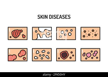 Jeu d'icônes de la ligne de couleur des maladies de la peau. Elément vectoriel isolé. Pictogrammes de contour pour la page Web, l'application mobile, la promotion. Illustration de Vecteur