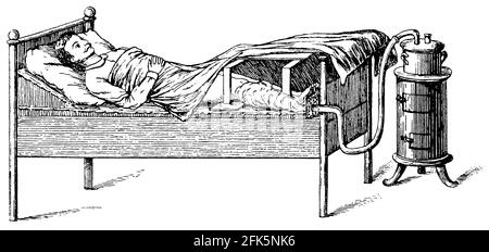 Bain de vapeur sur le lit (jambes). Illustration du 19e siècle. Allemagne. Arrière-plan blanc. Banque D'Images