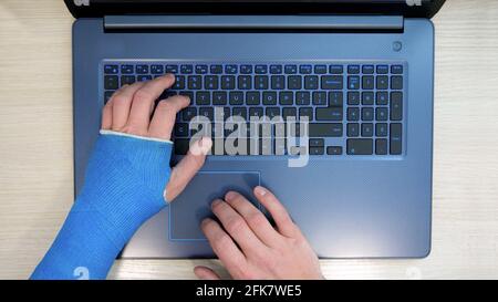 Vue de dessus d'une main défile sur le pavé tactile, l'autre main enveloppée dans du plâtre de fibre de verre moulé tapant sur un ordinateur portable sur un clavier. Un freelance avec un poignet cassé travaille l'Internet à la maison Banque D'Images