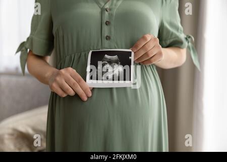 Gros plan de la femme enceinte montrer une image échographique Banque D'Images