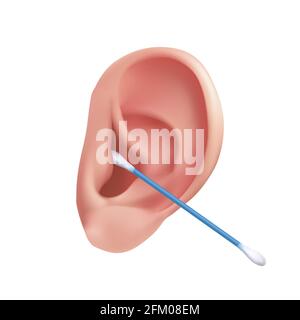 Hygiène du conduit auditif à l'aide d'un coton-tige. Vecteur illustration réaliste du nettoyage de l'oreille humaine de la cire d'oreille isolée sur un fond blanc Illustration de Vecteur