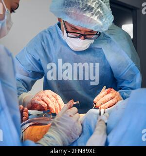 Chirurgien plastique mâle et assistante féminine effectuant le placement de sutures après opération chirurgicale plastique à l'hôpital. Personnel médical qui retire l'excès de graisse de l'abdomen du patient. Concept d'abdominoplastie Banque D'Images