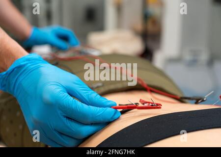 Croissez un physiothérapeute méconnaissable dans des gants stériles en insérant l'électrode de l'aiguille dans la peau arrière de la femme à l'hôpital Banque D'Images