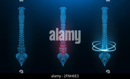 Illustration vectorielle polygonale d'une courbe de contrôle humaine. Image d'une colonne vertébrale saine, malade et en rétablissement. Illustration de Vecteur