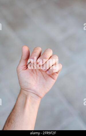 Main d'un homme avec des ongles mordus et laids. Mauvais soin des mains Banque D'Images