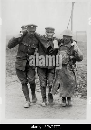 Première Guerre mondiale, première Guerre mondiale, front occidental - UN prisonnier allemand blessé de 16 ans (un tireur de machine) assisté, la France Banque D'Images