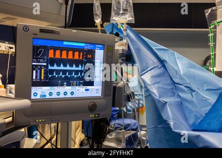 Moniteurs chirurgicaux utilisés pour suivre les signes vitaux d'un patient pendant une opération, France. Banque D'Images