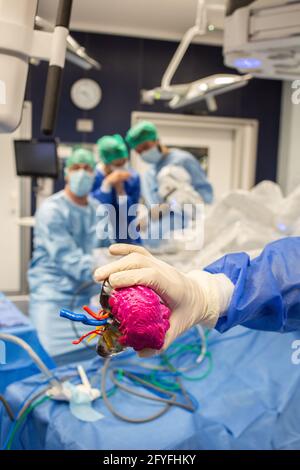 impression 3d d'un rein. La chirurgie rénale conservatrice robotique guidée par l'image assistée par la modélisation 3D, cette modélisation 3D du rein avec sa tumeur située i Banque D'Images