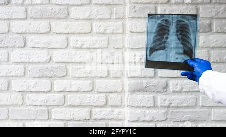 Rayons X des poumons humains. Le médecin diagnostique le patient. Radiographie thoracique. Banque D'Images