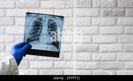 Rayons X des poumons humains. Le médecin diagnostique le patient. Radiographie thoracique. Banque D'Images