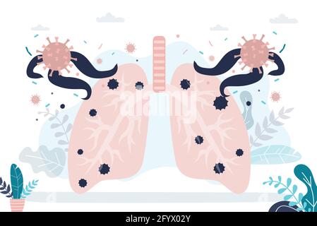 Poumons affectés par la pneumonie. Le coronavirus attaque et cause la maladie. Pandémie Covid-19. Bannière problèmes de santé. Maladie des voies respiratoires. Styl tendance Illustration de Vecteur