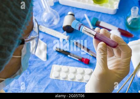 TBILISSI, GÉORGIE - 09 octobre 2020 : échantillon de tube de test sanguin de créatinine dans les médecins main en laboratoire, les médecins font face Banque D'Images