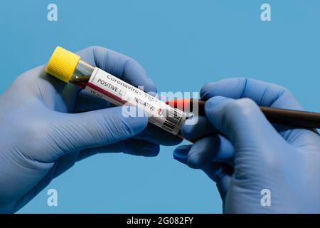 Main du médecin rognée non reconnaissable montrant et faisant avec le stylo A. Test sanguin négatif du coronavirus sur fond rose Banque D'Images