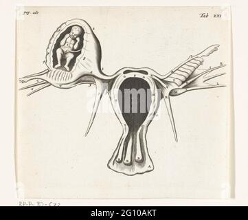 Représentation anatomique d'une grossesse extra-utérine. En 1672, le médecin et anatomiste Reinier de Graaf a publié de mulierum organiss, un livre sur les organes du corps féminin, avec des reproductions d'Hendrik Bary. De Graaf a été le premier à conclure qu’un fœtus grandit à partir de la cellule d’œuf de la mère après avoir été fécondé par la semence du père. Il discute également des anomalies telles que les grossesses extra-utérines (quand les implants d'oeufs fécondés à l'extérieur de l'utérus). Banque D'Images