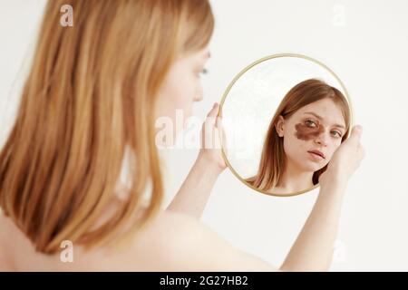 Jeune femme avec grand spot marron sur le visage sous l'œil regardant la réflexion miroir sur fond blanc Banque D'Images