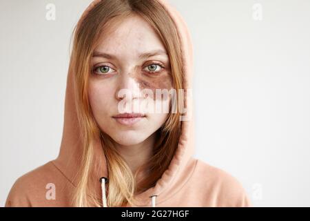 Crop jeune femme regardant l'appareil photo tout en se tenant dans le sweat à capuche avec le point de nevus marron sur la joue Banque D'Images