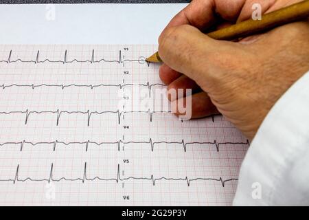 Médecin qui analyse un ECG 12 dérivations et marque les ondes P présentes dans le tracé à l'aide d'un crayon, en gros plan Banque D'Images