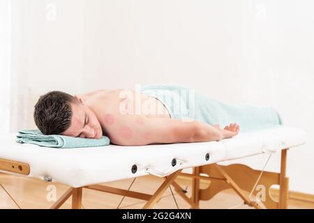 Un jeune homme se fait passer un soin sous vide dans un spa. Traitement par trempage. Traitement utilisé en médecine traditionnelle chinoise pour le soulagement de la douleur et d'autres soins de santé Banque D'Images