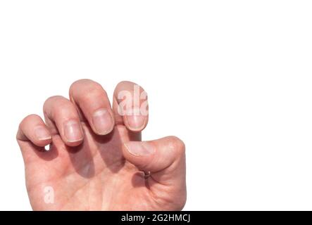 Gros plan de ongles naturels brisés faibles, dépourvus de nutriments, aucune manucure isolée sur fond blanc. Concept pour les ongles naturels, ongles bruts. Manucure a Banque D'Images