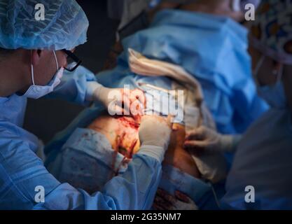 Médecin en masque médical effectuant une chirurgie abdominale en plastique dans la salle d'opération, en plaçant des sutures après la chirurgie tummy. Concentrez-vous sur le visage du chirurgien. Concept de l'abdominoplastie et de la chirurgie esthétique. Banque D'Images