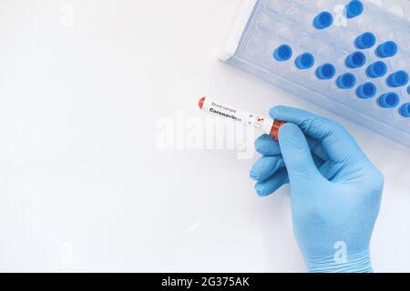 vue de dessus de la main dans des gants médicaux bleus tenant le tube à essai avec espace de copie Banque D'Images