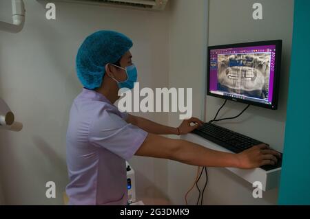 Un technicien cambodgien de radiologie dentaire, portant un masque facial et une moustiquaire, regarde une radiographie des dents sur un écran d'ordinateur dans une clinique dentaire pendant la pandémie du coronavirus. Phnom Penh, Cambodge. 12 mai 2020. © Kraig Lieb Banque D'Images