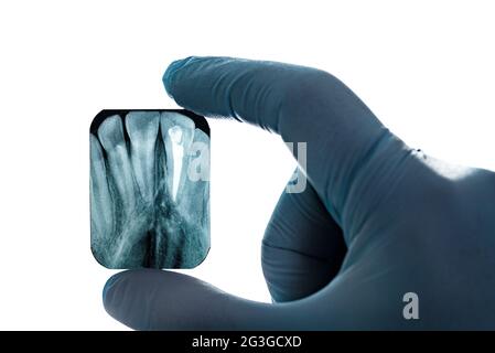 Radiographie imagerie dents canines supérieures canal racinaire main dans gant film aboratoire isolé Banque D'Images