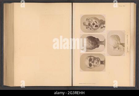 Quatre images d'un crâne samique; Cranio Lappone, di Kautokino, N. 2607. En haut à gauche, une vue de face, au milieu d'une vue de derrière, en haut à droite d'une vue de dessous, sous une vue latérale. Banque D'Images