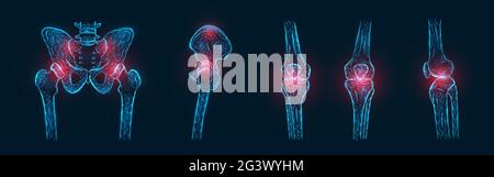 Illustration vectorielle polygonale de la douleur ou de l'inflammation des os du bassin, de l'articulation de la hanche et des articulations du genou isolées. pai joint Banque D'Images