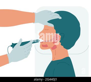 Chirurgie pour enlever une pierre du conduit de la glande salivaire parotide. Banque D'Images