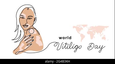 World vitiligo day vector bannière, poster, fond. Femme avec taches de peau. Un dessin d'art en ligne continu avec lettre vitiligo jour Illustration de Vecteur
