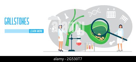 Vecteur de concept de vésicule biliaire. Les médecins traitent les calculs biliaires. Ptoblèmes de dyskinésie biliaire. Web, modèle de page d'arrivée pour le site Web médical, bannière. Support médical Illustration de Vecteur