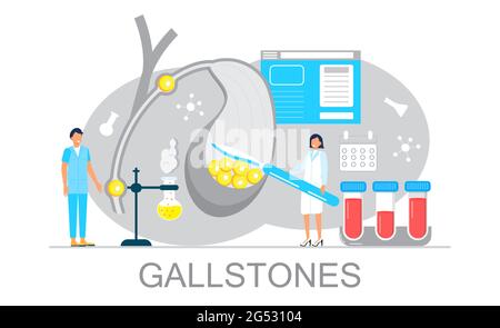 Vecteur de concept de vésicule biliaire. Les médecins traitent les calculs biliaires. Ptoblèmes de dyskinésie biliaire. Web, modèle de page d'arrivée pour le site Web médical, bannière. Support médical Illustration de Vecteur