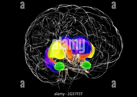 Striatum dorsal dans la maladie de Huntington, illustration Banque D'Images