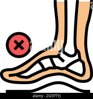 illustration vectorielle de la couleur des pieds de la déformation posturale osseuse Illustration de Vecteur