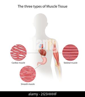 Les trois types de tissu musculaire du corps humain. Schéma Banque D'Images