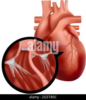 Cœur humain réaliste avec vue en coupe rapprochée. Illustration d'un organe cardiaque. Illustration de Vecteur