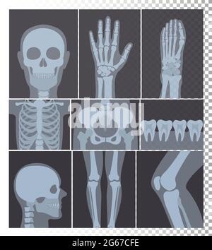 Illustration vectorielle d'une collection réaliste de clichés radiographiques. Images radiographiques de la tête, des os, du jeu de dents, des parties du corps ensemble de rayons X sur fond transparent. Illustration de Vecteur