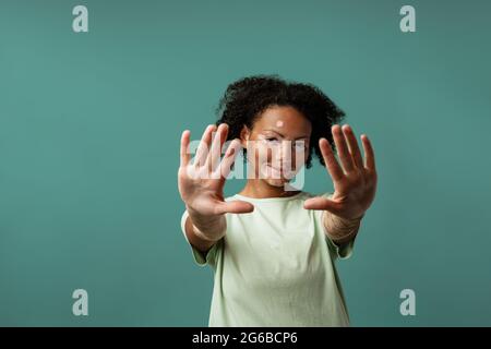 Jeune femme avec le vitiligo souriant tout en atteignant ses mains à la caméra isolée sur le mur bleu Banque D'Images