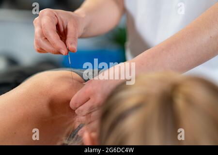 Physiothérapeute méconnaissable insérant l'aiguille dans l'épaule d'une patiente détendue pendant la séance d'acupuncture en clinique Banque D'Images